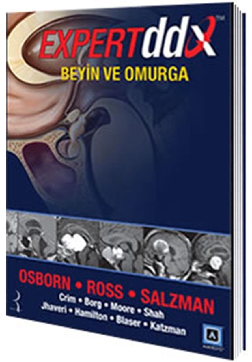 Expert DDX Beyin ve Omurga Pelikan Yayınevi